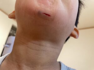 子どもの転倒対策に床コーティング【愛知名古屋守山店】